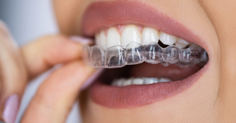 invisalign em laranjeiras
