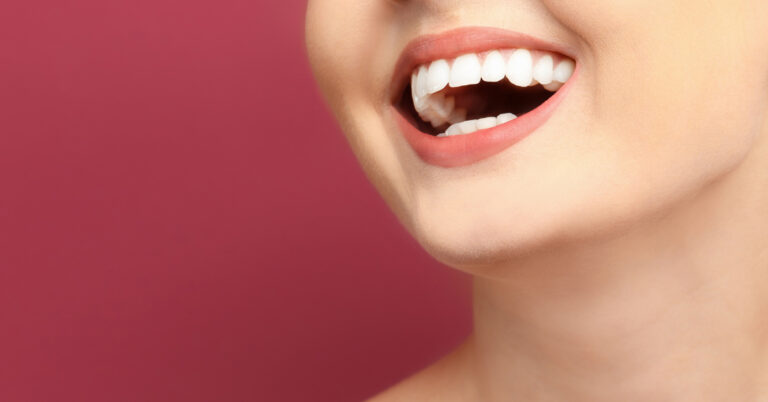 clareamento dental em laranjeiras