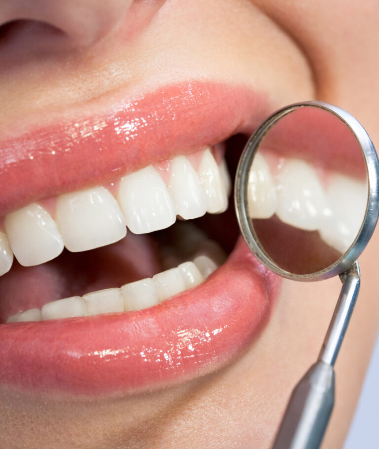 Fechamento de Diastema em Laranjeiras fechamento de diastema
