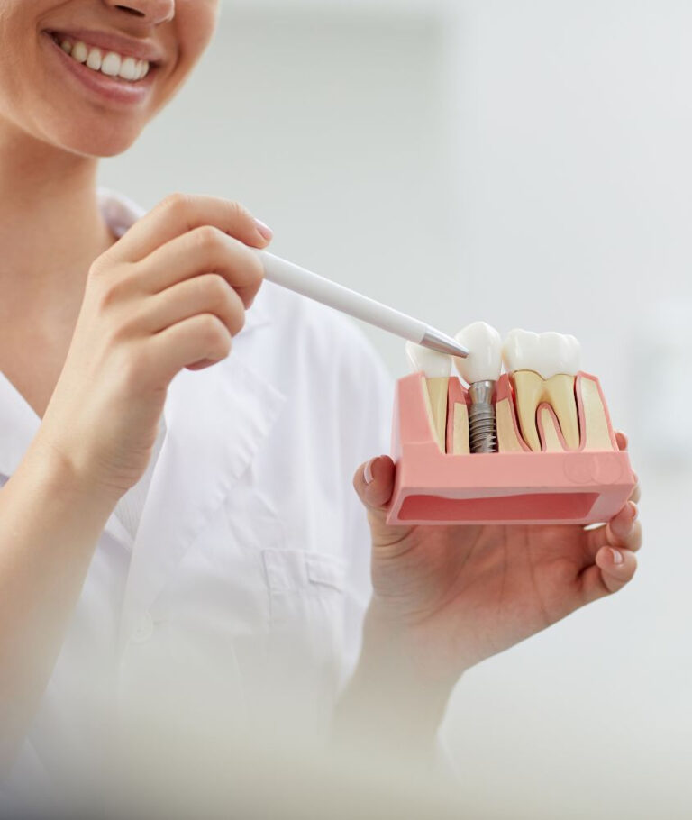 Implante Dentário em Laranjeiras implante dentário