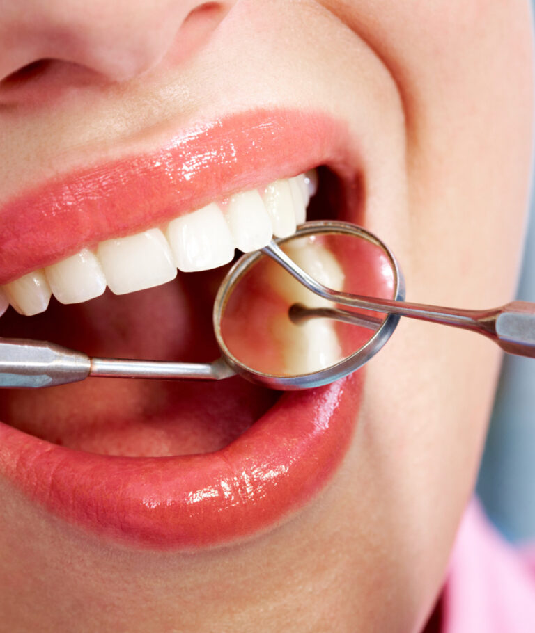Restauração Dentária em Laranjeiras restauração dental